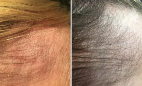 Utilisation de la brosse de massage