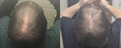 Vue détaillée de la brosse de massage